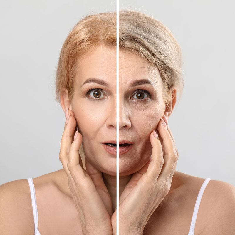 Age Reversal Peel